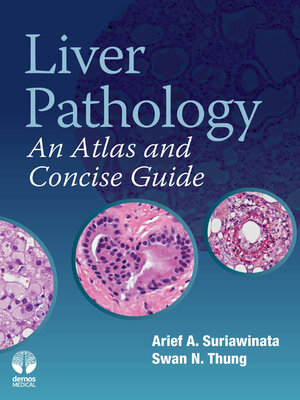 cover image of Liver Pathology